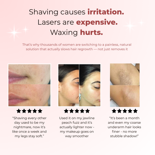 Rotundus Hair removal oil